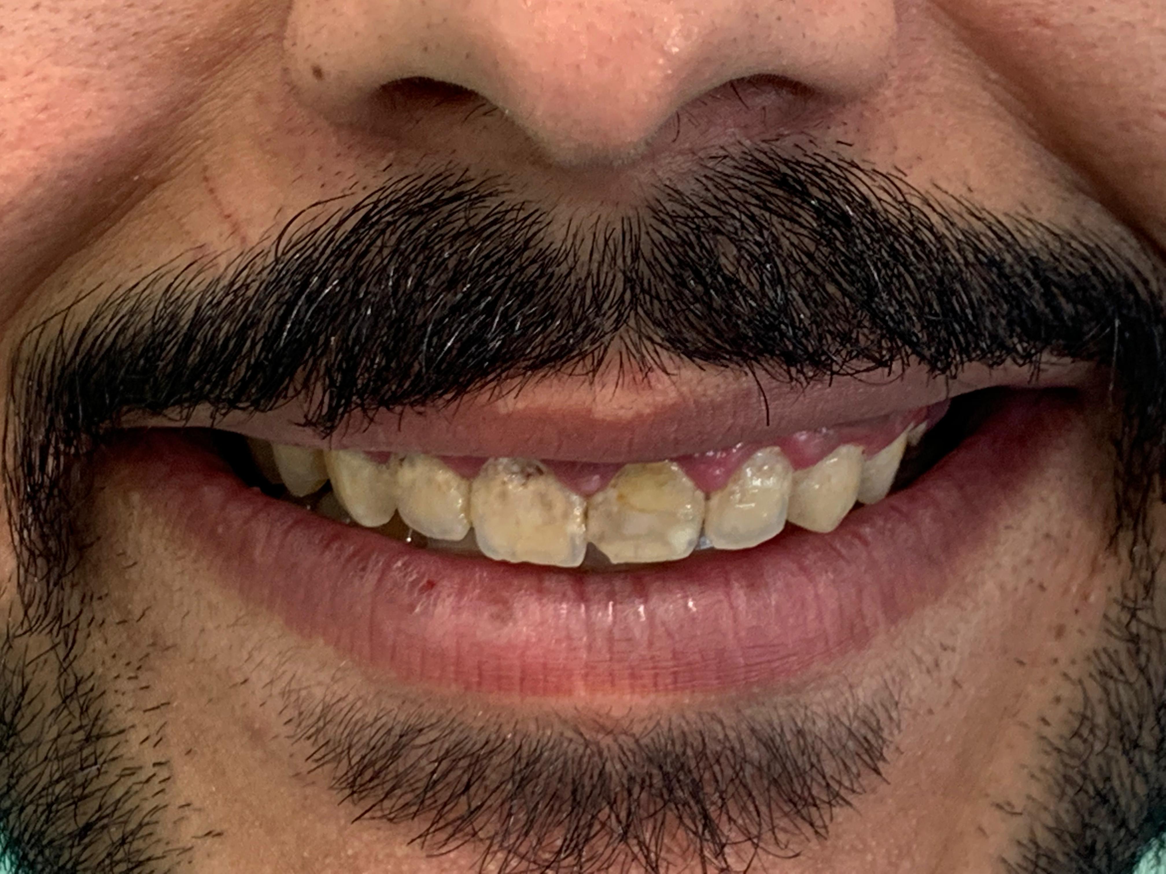 تحميل فوري - نفس اليوم - قبل